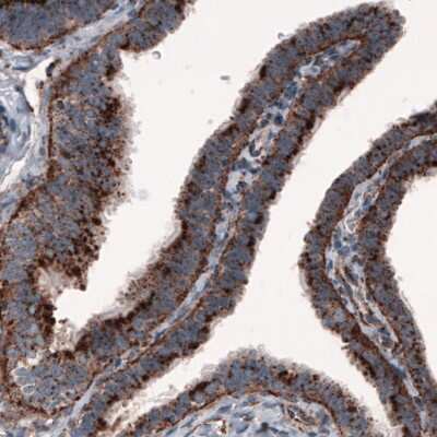 Immunohistochemistry-Paraffin: LAMP-1/CD107a Antibody (CL3482) [NBP2-61619]