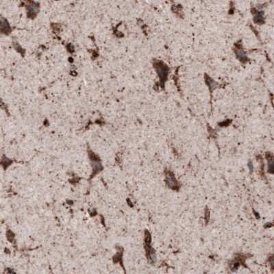 Immunohistochemistry-Paraffin: LAMP-1/CD107a Antibody (CL3482) [NBP2-61619]