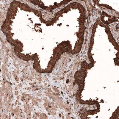 Immunohistochemistry-Paraffin: LAMP-1/CD107a Antibody (CL4463) [NBP2-59051]