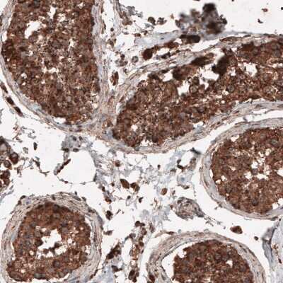 Immunohistochemistry-Paraffin: LAMP-1/CD107a Antibody (CL4463) [NBP2-59051]