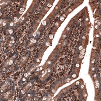 Immunohistochemistry-Paraffin: LAMP-1/CD107a Antibody (CL4463) [NBP2-59051]