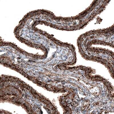 Immunohistochemistry-Paraffin: LAMP-1/CD107a Antibody (CL4472) [NBP2-59052]