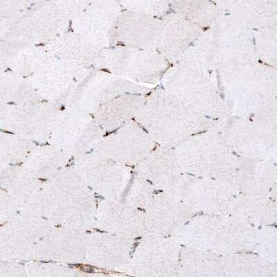 Immunohistochemistry-Paraffin: LAMP-1/CD107a Antibody (CL4472) [NBP2-59052]