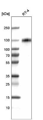 Western Blot: LAMP-1/CD107a Antibody (CL4472) [NBP2-59052]