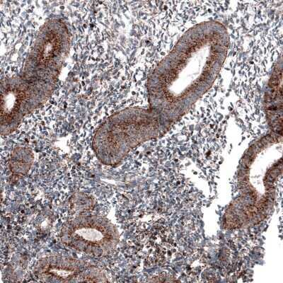 Immunohistochemistry-Paraffin: LAMP-1/CD107a Antibody (CL4489) [NBP2-59053]