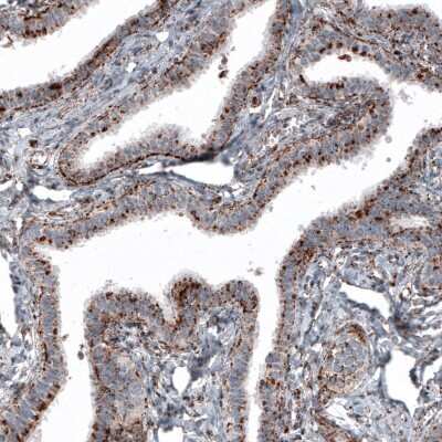 Immunohistochemistry-Paraffin: LAMP-1/CD107a Antibody (CL4490) [NBP2-59054]