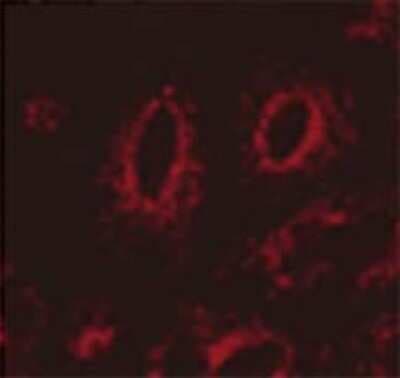 Immunocytochemistry/ Immunofluorescence: LAMP-1/CD107a Antibody (LY1C6) [NB100-1952]