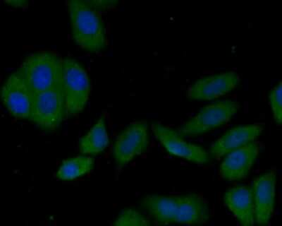 Immunocytochemistry/ Immunofluorescence: LAMP-2/CD107b Antibody (C9-9) [NBP2-66929]