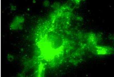 Immunocytochemistry/ Immunofluorescence: LAMP-2/CD107b Antibody (GL2A7) [NBP1-97499]
