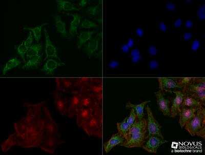 Immunocytochemistry/ Immunofluorescence: LAMP-2/CD107b Antibody (H4B4) - BSA Free [NBP2-22217]