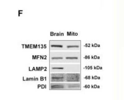 Western Blot: LAMP-2/CD107b Antibody (H4B4)BSA Free [NBP2-22217]