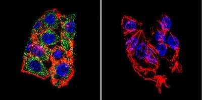 Immunocytochemistry/ Immunofluorescence: LAMP-2/CD107b Antibody [NB300-591]