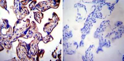 Immunohistochemistry-Paraffin: LAMP-2/CD107b Antibody [NB300-591]