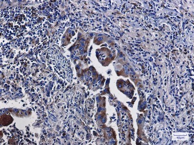 Immunohistochemistry-Paraffin: LAMP-2/CD107b Antibody (S02-3F4) [NBP3-19551]