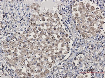 Immunohistochemistry-Paraffin: LAMP-2/CD107b Antibody (S03-0B5) [NBP3-19884]