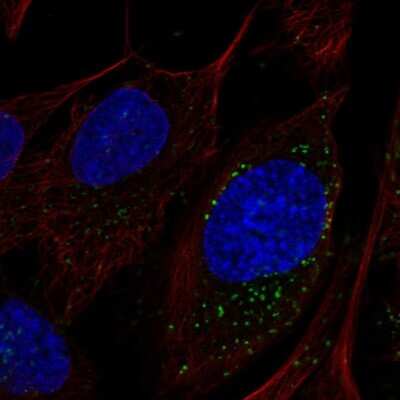 Immunocytochemistry/ Immunofluorescence: LAMTOR4 Antibody [NBP1-90936]