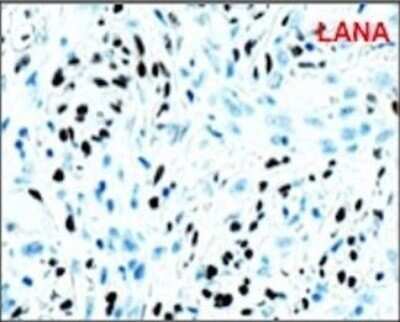 Immunocytochemistry: LANA2 Antibody (CM-A807) - Azide and BSA Free [NBP2-80826]