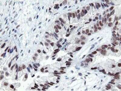 Immunohistochemistry: LANCL2 Antibody (OTI1C5) [NBP2-45611]