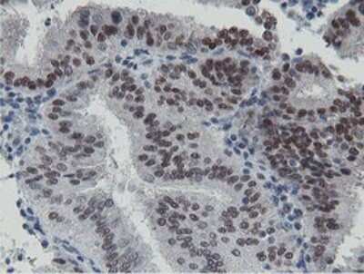 Immunohistochemistry: LANCL2 Antibody (OTI1C5) [NBP2-45611]
