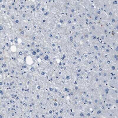 Immunohistochemistry-Paraffin: LANCL2 Antibody [NBP1-83339]