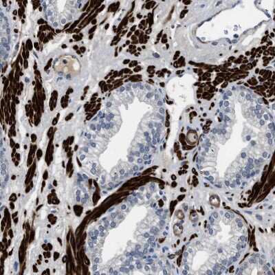 Immunohistochemistry-Paraffin: LANCL2 Antibody [NBP1-83339]