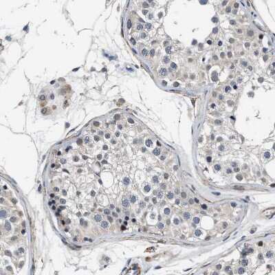 Immunohistochemistry-Paraffin: LANCL2 Antibody [NBP1-83339]