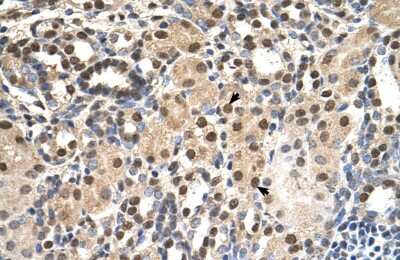Immunohistochemistry-Paraffin: LANPL Antibody [NBP1-56294]