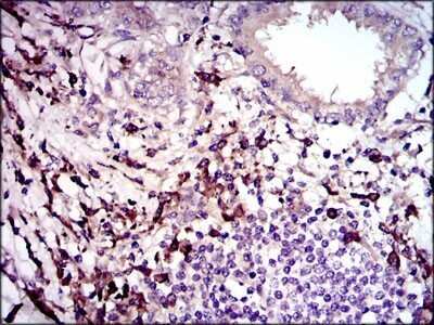 Immunohistochemistry: LAP (TGF-beta 1) Antibody (7F6) - Azide and BSA Free [NBP2-80827]