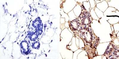 Immunohistochemistry: LAP1 Antibody (RL13) - BSA Free [NB120-2737]