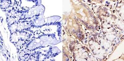 Immunohistochemistry-Paraffin: LAP1 Antibody (RL13) - BSA Free [NB120-2737]