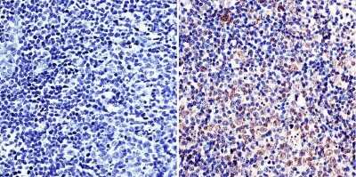 Immunohistochemistry-Paraffin: LAP1 Antibody (RL13) - BSA Free [NB120-2737]