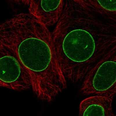 Immunocytochemistry/ Immunofluorescence: LAP1B Antibody [NBP2-47403]