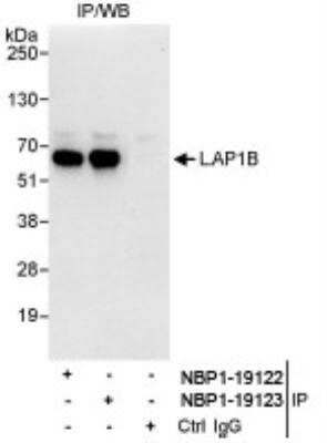 Immunoprecipitation: LAP1B Antibody [NBP1-19123]