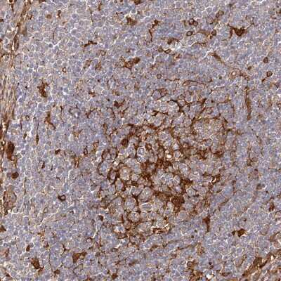 Immunohistochemistry-Paraffin: LAP3 Antibody [NBP1-82848]