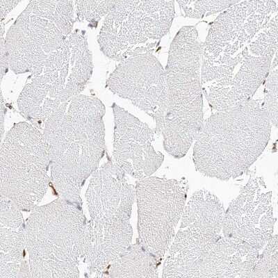 Immunohistochemistry-Paraffin: LAP3 Antibody [NBP1-82848]