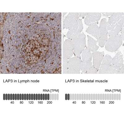 Immunohistochemistry-Paraffin: LAP3 Antibody [NBP1-82848]