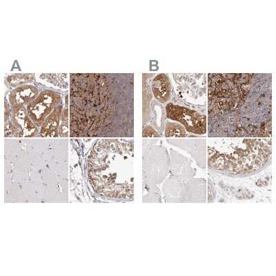 Immunohistochemistry-Paraffin: LAP3 Antibody [NBP1-82848]