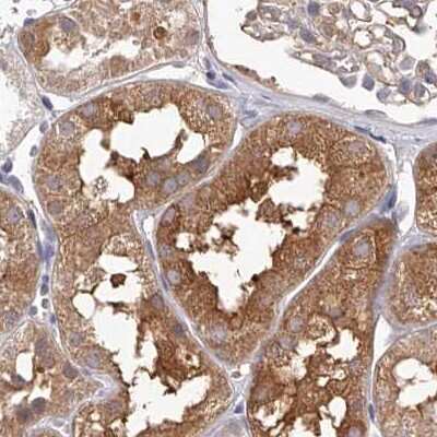 Immunohistochemistry-Paraffin: LAP3 Antibody [NBP1-82848]