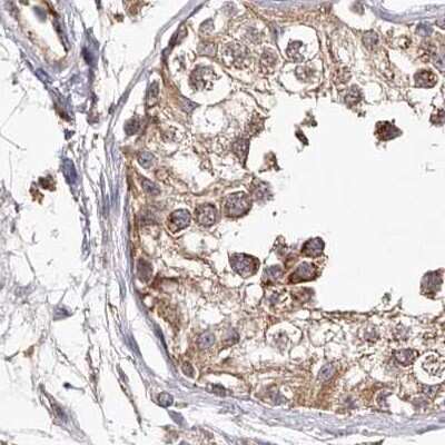Immunohistochemistry-Paraffin: LAP3 Antibody [NBP1-82848]