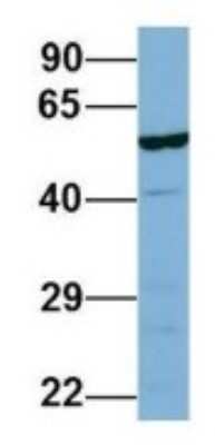 Western Blot: LAP3 Antibody [NBP1-53152]
