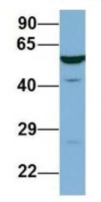 Western Blot: LAP3 Antibody [NBP1-53152]