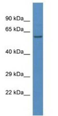 Western Blot: LAP3 Antibody [NBP1-79642]