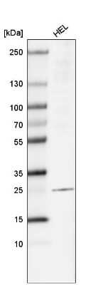 Western Blot: LAPTM4B Antibody (CL5289) [NBP2-61158]