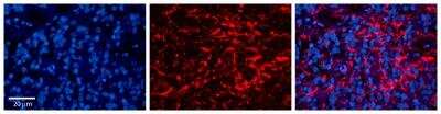 Immunohistochemistry-Paraffin: LAPTM4B Antibody [NBP1-59416]