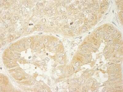 Immunohistochemistry-Paraffin: LARP1 Antibody [NBP1-19129]