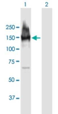 Western Blot: LARP1 Antibody [H00023367-B01P]