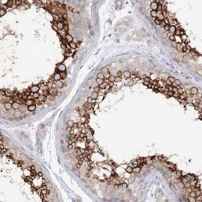 Immunohistochemistry-Paraffin: LARP2 Antibody [NBP1-84184]