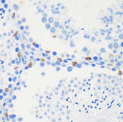 Immunohistochemistry-Paraffin: LARP2 Antibody - Azide and BSA Free [NBP3-03504]