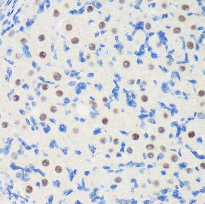 Immunohistochemistry-Paraffin: LARP2 Antibody - Azide and BSA Free [NBP3-03504]