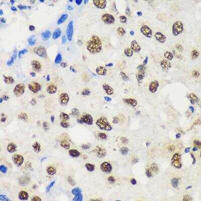 Immunohistochemistry-Paraffin: LARP2 Antibody - Azide and BSA Free [NBP3-03504]